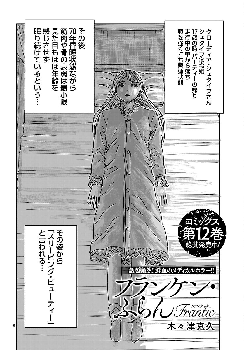 Franken Fran Frantic - Chapter 83 - Page 2