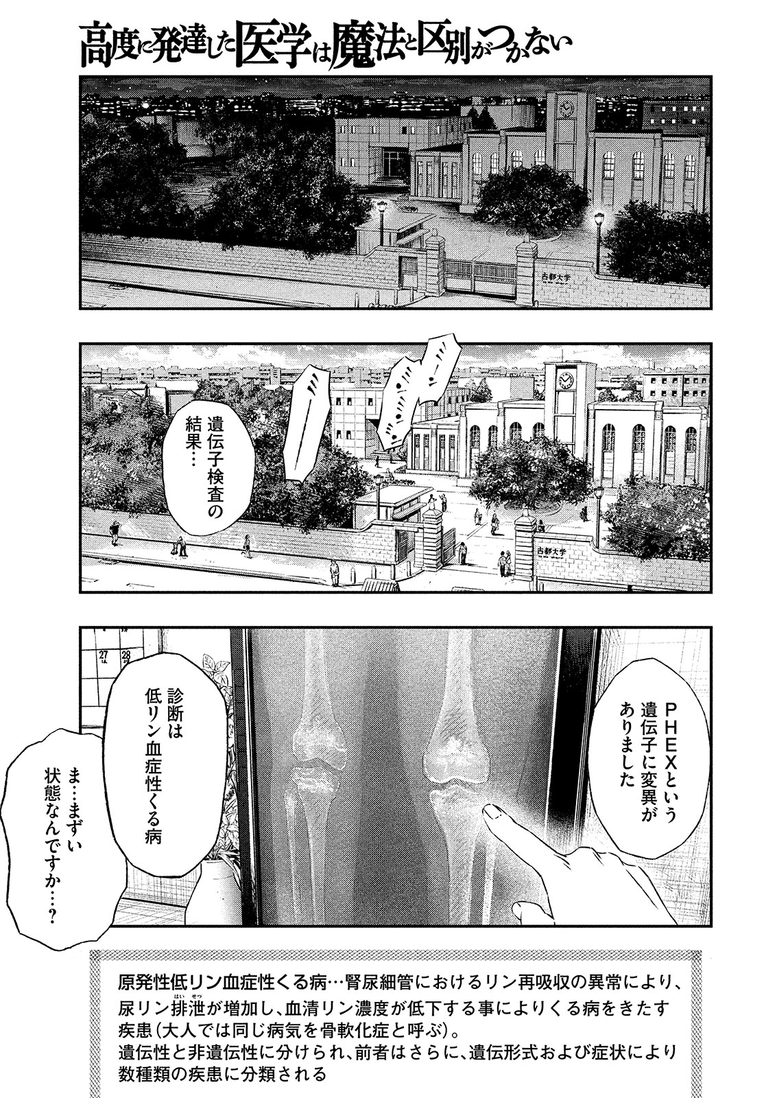 に発達した医学は魔法と区別がつかない Chap 1 - Next Chap 2
