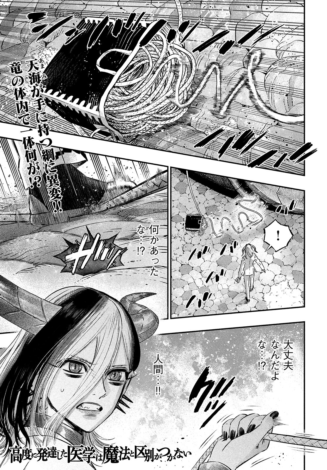 に発達した医学は魔法と区別がつかない Chap 8 - Next Chap 9