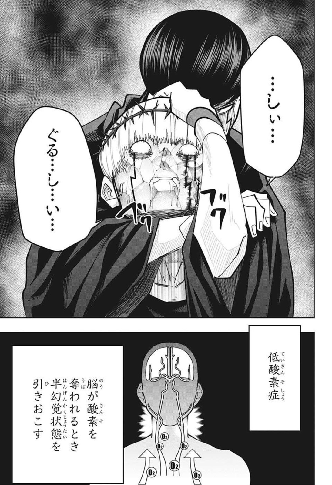 MASHLE - Chapter 67 - Page 20