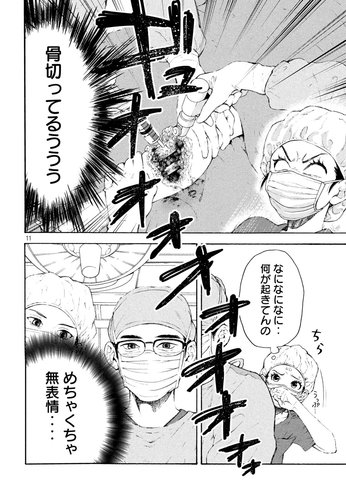 OpeKan - Chapter 1 - Page 11