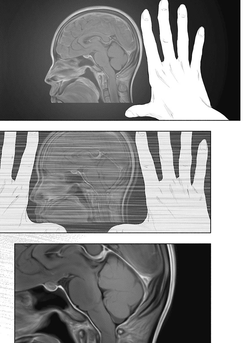 ラジエーションハウス Chap 78 - Next Chap 79